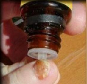 Mantardan etkilenen ayak tırnağına damla uygulanması