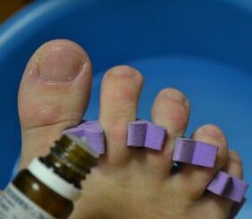 Tırnakları mantar önleyici damlalarla tedavi etmeye hazırlanıyor